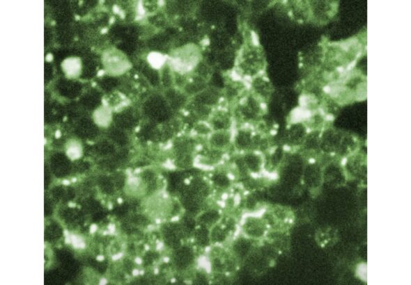 How Rare Are Measles Deaths in the U.S. as Rates Fall?